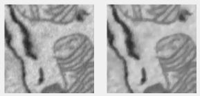 Anisotropic Diffusion