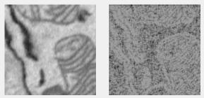 Entropy Filter
