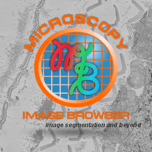 MIB Splash